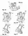 Fig. 16 - Multi-port access device for minimally invasive surgical procedures
