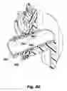 Fig. 30 - Multi-port access device for minimally invasive surgical procedures