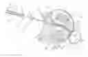 Fig. 01 - Nested needles for spinal cyst treatment