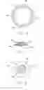 Fig. 05 - COLLECTION APPARATUS