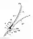 Fig. 01 - Bone anchor