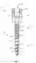 Fig. 02 - Spinal implant system and method