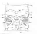 Fig. 01 - Lamina implant and method