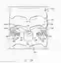 Fig. 03 - Lamina implant and method