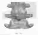 Fig. 04 - Lamina implant and method