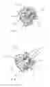 Fig. 02 - Fixation systems and methods of repairing a pars fracture