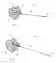 Fig. 09 - Fixation systems and methods of repairing a pars fracture