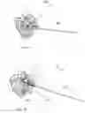 Fig. 10 - Fixation systems and methods of repairing a pars fracture