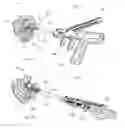 Fig. 15 - Fixation systems and methods of repairing a pars fracture