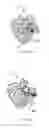 Fig. 18 - Fixation systems and methods of repairing a pars fracture