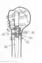 Fig. 01 - Expandable bone nail
