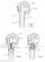 Fig. 02 - Expandable bone nail