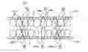Fig. 01 - Intermaxillary fixation device and method of using same