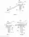 Fig. 05 - Intermaxillary fixation device and method of using same