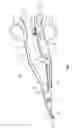 Fig. 02 - Knife lockout for electrosurgical forceps