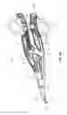 Fig. 03 - Knife lockout for electrosurgical forceps
