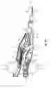 Fig. 04 - Knife lockout for electrosurgical forceps
