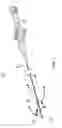 Fig. 02 - Catheter with composite insert support member