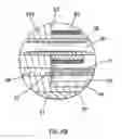 Fig. 07 - Catheter with composite insert support member
