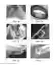 Fig. 02 - Tuned RF energy and electrical tissue characterization for selective treatment of target tissues