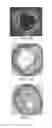 Fig. 03 - Tuned RF energy and electrical tissue characterization for selective treatment of target tissues