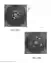 Fig. 34 - Tuned RF energy and electrical tissue characterization for selective treatment of target tissues