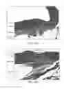 Fig. 58 - Tuned RF energy and electrical tissue characterization for selective treatment of target tissues