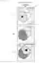 Fig. 11 - Treatment support apparatus and treatment support method