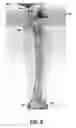 Fig. 07 - Intraoperative systems and methods for determining and providing for display a virtual image overlaid onto a visual image of a bone