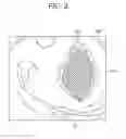 Fig. 04 - Device, method, and system for image guided surgical resection