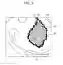 Fig. 06 - Device, method, and system for image guided surgical resection