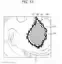 Fig. 13 - Device, method, and system for image guided surgical resection