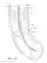 Fig. 20 - Body-inserted tube cleaning