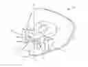 Fig. 01 - LINGUAL ORTHODONTIC APPLIANCE