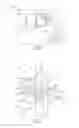 Fig. 02 - LINGUAL ORTHODONTIC APPLIANCE