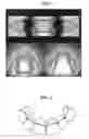 Fig. 03 - System of manufacturing orthodontic wire, method for manufacturing the orthodontic wire using the same, and orthodontic wire bending machine for performing the same