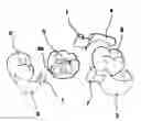 Fig. 01 - DENTAL PROSTHESIS AND ITS MANUFACTURING METHOD
