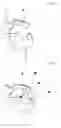 Fig. 05 - DENTAL PROSTHESIS AND ITS MANUFACTURING METHOD