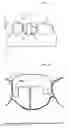 Fig. 09 - DENTAL PROSTHESIS AND ITS MANUFACTURING METHOD