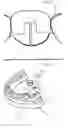 Fig. 10 - DENTAL PROSTHESIS AND ITS MANUFACTURING METHOD