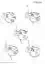 Fig. 13 - DENTAL PROSTHESIS AND ITS MANUFACTURING METHOD