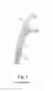 Fig. 02 - ADJUSTABLE INTERDENTAL CLEANING ELEMENT AND A DEVICE AND METHOD THEREFOR