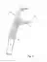 Fig. 04 - ADJUSTABLE INTERDENTAL CLEANING ELEMENT AND A DEVICE AND METHOD THEREFOR
