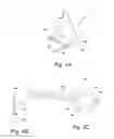 Fig. 05 - ADJUSTABLE INTERDENTAL CLEANING ELEMENT AND A DEVICE AND METHOD THEREFOR
