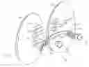 Fig. 01 - Gluteal implants and implant systems
