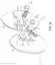 Fig. 02 - Gluteal implants and implant systems