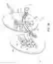 Fig. 03 - Gluteal implants and implant systems