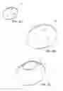 Fig. 15 - Gluteal implants and implant systems
