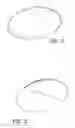 Fig. 25 - Gluteal implants and implant systems