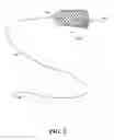 Fig. 03 - Exchange wire anchored by a self-expanding retrievable stent and method of use